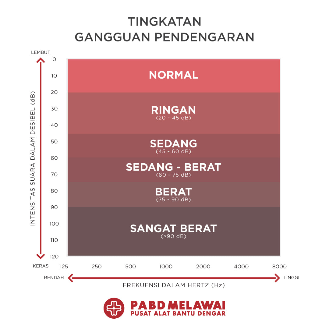 Derajat Gangguan Pendengaran Normal - Tuli